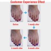 Bunion Corrector Silicone Toe Sleeves and Separator